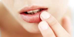 Что такое рак губы? Отвечают специалисты
