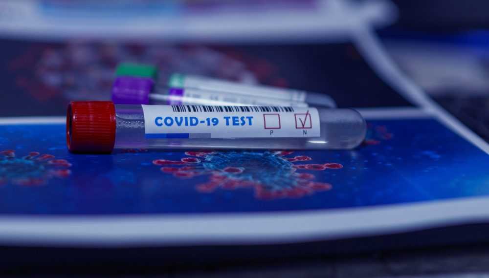 В Брянске предложили всем отпускникам сдавать тесты на коронавирус