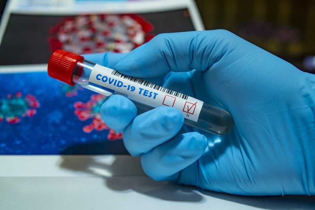 В Брянской области за сутки выявили 19 заражённых коронавирусом жителей