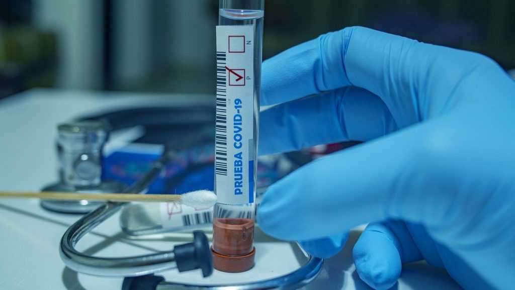 В Брянской области за сутки заразились коронавирусом 256 человек