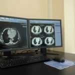 На покупку томографов для брянских больниц потратят 428 млн рублей