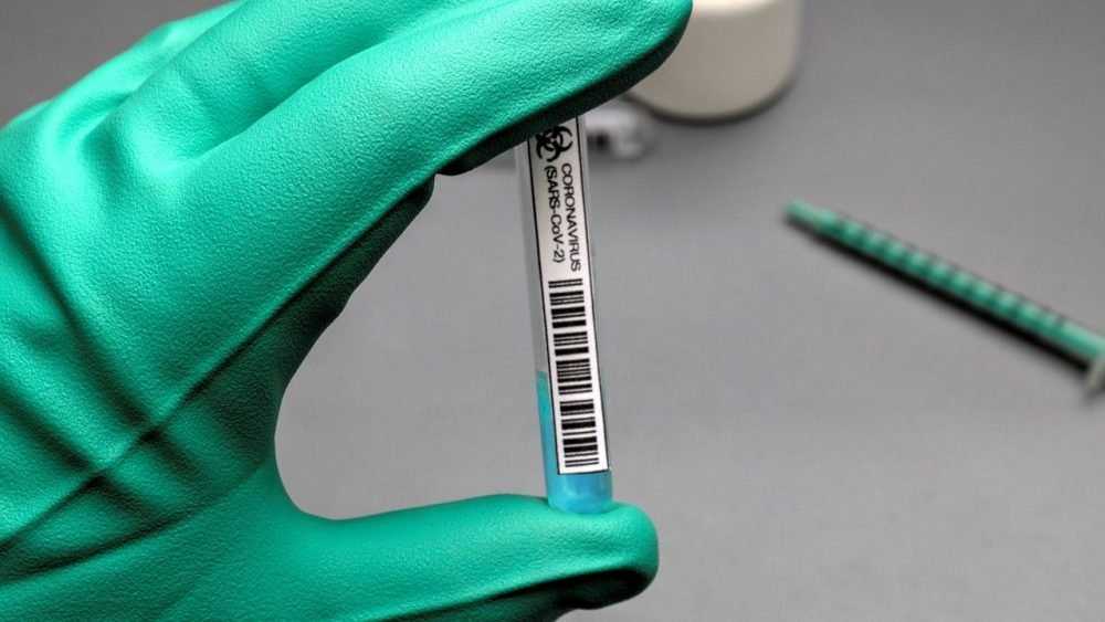 В Брянской области за сутки выявили 18 заболевших коронавирусом пациентов