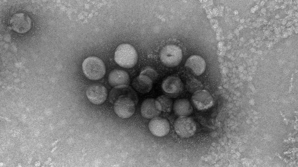 Ученые выявили еще один источник заражения коронавирусом