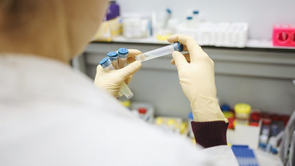 В Брянской области за минувшие сутки выявили 40 заразившихся коронавирусом жителей