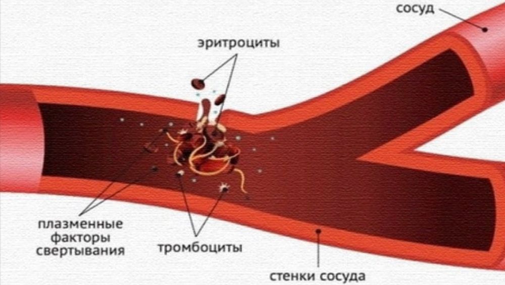 В Брянске специалисты создали новый компонент донорской крови